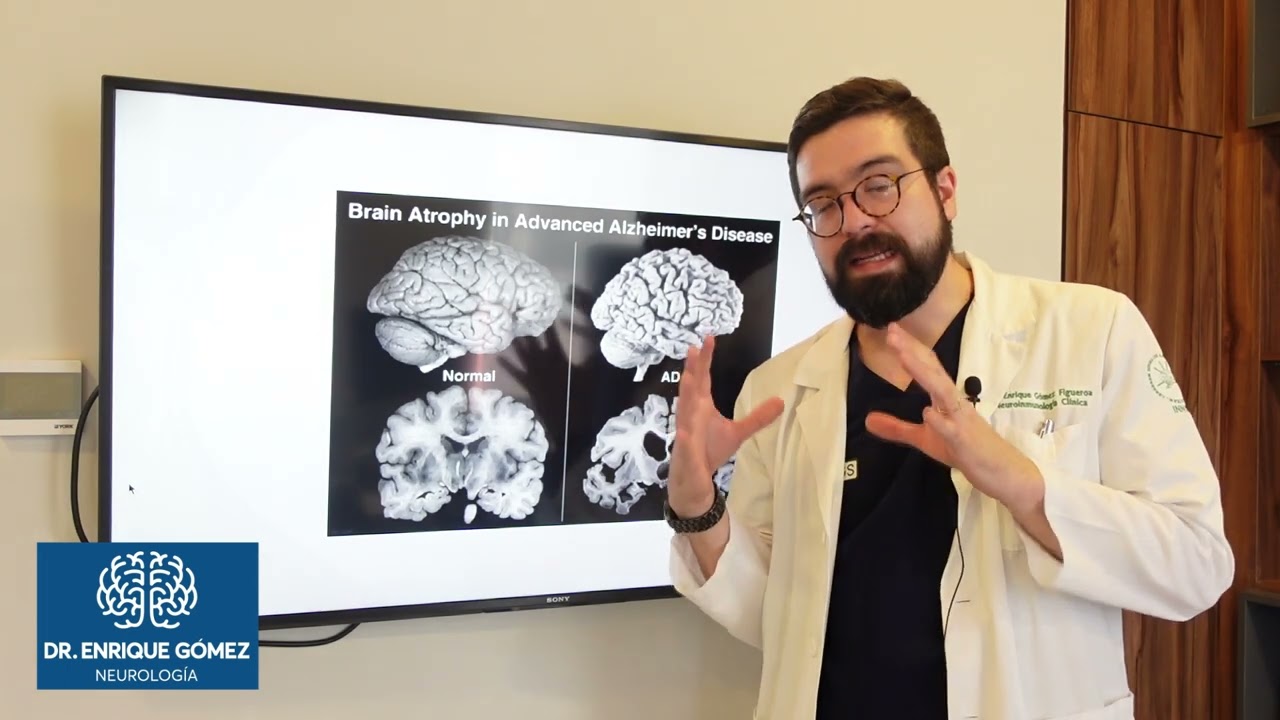 resonancia cerebral con pérdida que significa