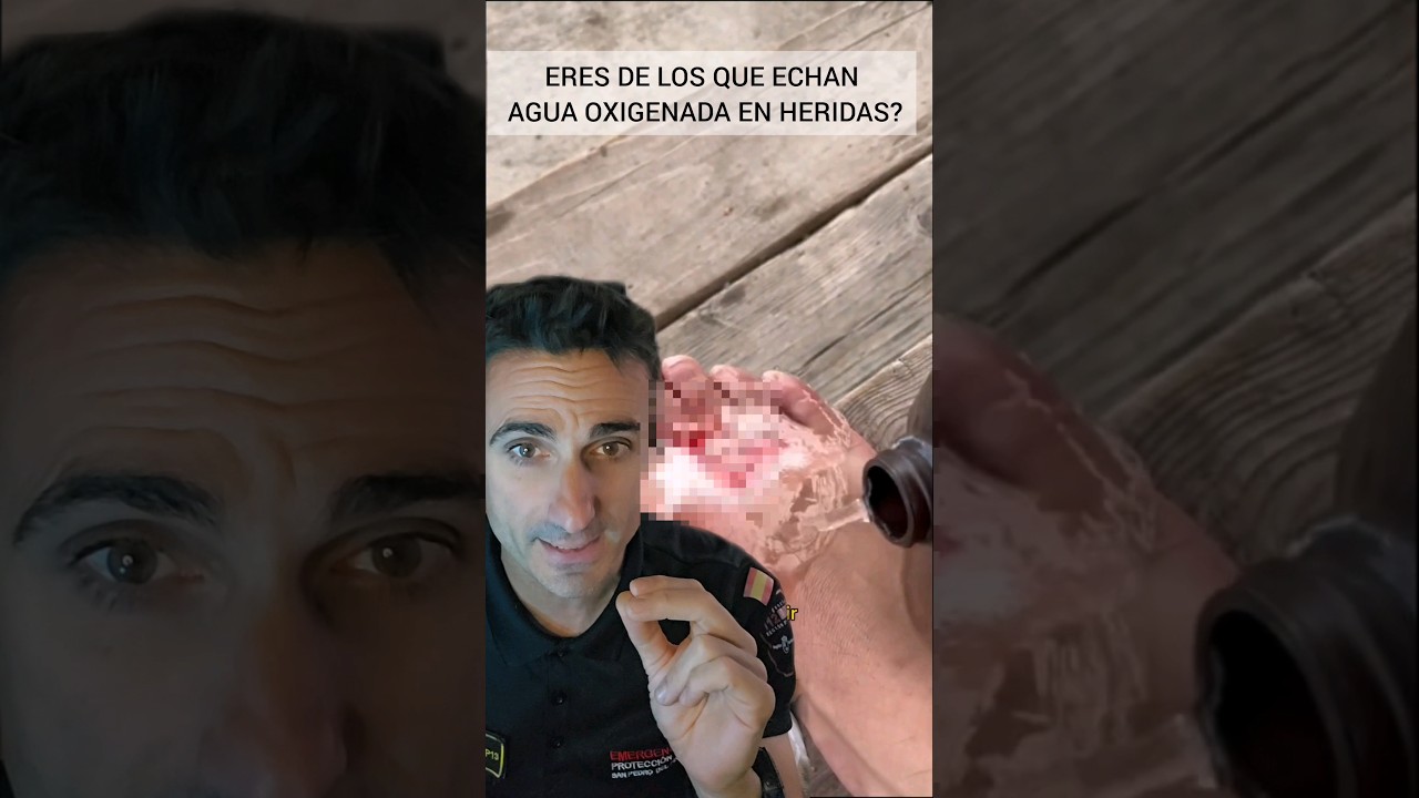 alimentos que reaccionan con el agua oxigenada